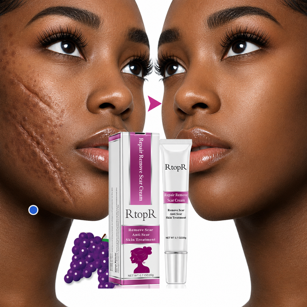 Acne Scar Removal Cream for Skin Repair and Healing